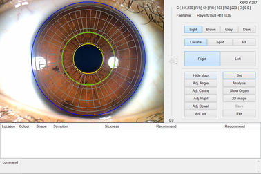 L'analizzatore tenuto in mano dell'analizzatore dell'iride dell'occhio del CE portatile per salute individua