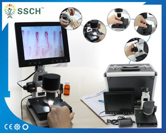 Microcircolazione medica del capillare del microscopio dello schermo LCD approvato del CE