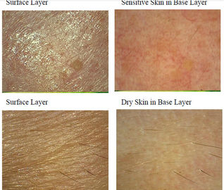 Macchina uv facciale dell'analizzatore della pelle per pelle Mositure/grasso/grinza/pigmentazione