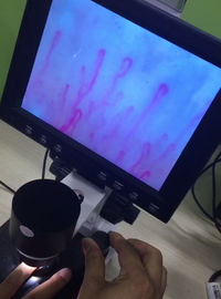 Microscopio di microcircolazione di Next Generation, microscopio del vaso sanguigno per la sanità