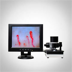Microscopio clinico di microcircolazione di analisi del sangue dell'esposizione di salute della macchina LCD dell'analizzatore