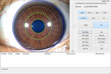 approvazione della macchina di prova dell'occhio della macchina fotografica di 12.0MP Digital Iriscope Iridology CE/DHL