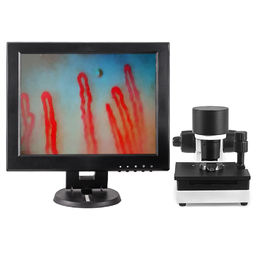 Uscita capillare di ingrandimento DC12V 2A del microscopio 600X di microcircolazione del sangue