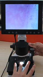 Colori i pixel capillari del microscopio 380000 dell'attrezzatura della microcircolazione del Nailfold con CE