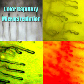Microscopia capillare del Nailfold dell'ospedale/funzione microscopio di microcircolazione multi per medico
