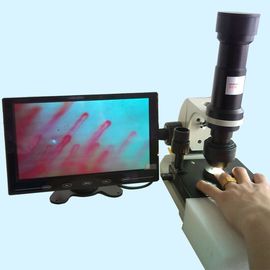 Microscopia capillare del Nailfold dell'ospedale/funzione microscopio di microcircolazione multi per medico