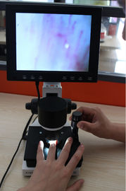Microcircolazione LCD di alta definizione che controlla strumento di rilevazione del Nailfold del microscopio il video