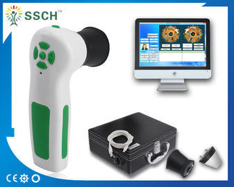 Analizzatore bianco di diagnosi dell'analizzatore della pelle di USB della macchina fotografica di Iriscope Iridology