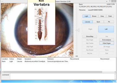 Analizzatore medico dell'iride dell'occhio della macchina fotografica digitale di Megapixel di portata dell'iride di 12.0MP USB